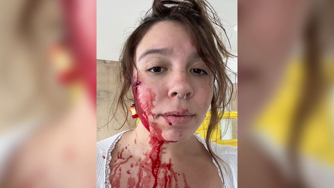 Lilli: 'Look At My Face And Tell Me We Don't Need Gun Control' - Vimarsana News